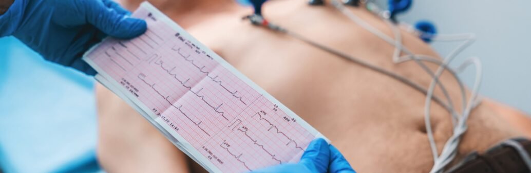 ECG ECG
